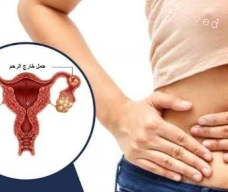 Surgical Treatment of Ectopic Pregnancy